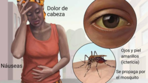 FIEBRE-AMARILLA-1