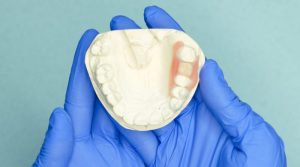 EDENTUALISMO-PROTESIS-DENTAL-800x445