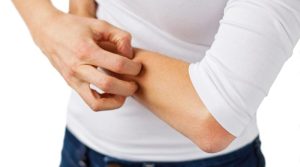 DERMATITIS-800x445