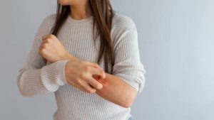 PSORIASIS2